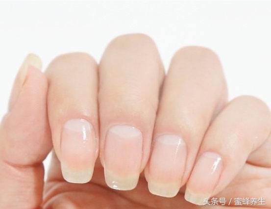 关于指甲那些不得不说的健康事儿