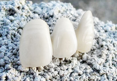 做完烤瓷牙后注意事项,做烤瓷牙前要问清楚的事情