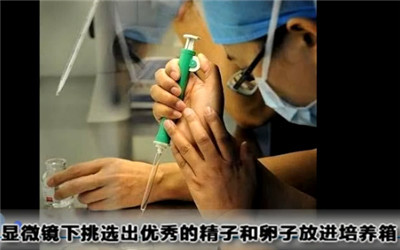 试管婴儿过程痛苦么,试管婴儿到底有多遭罪