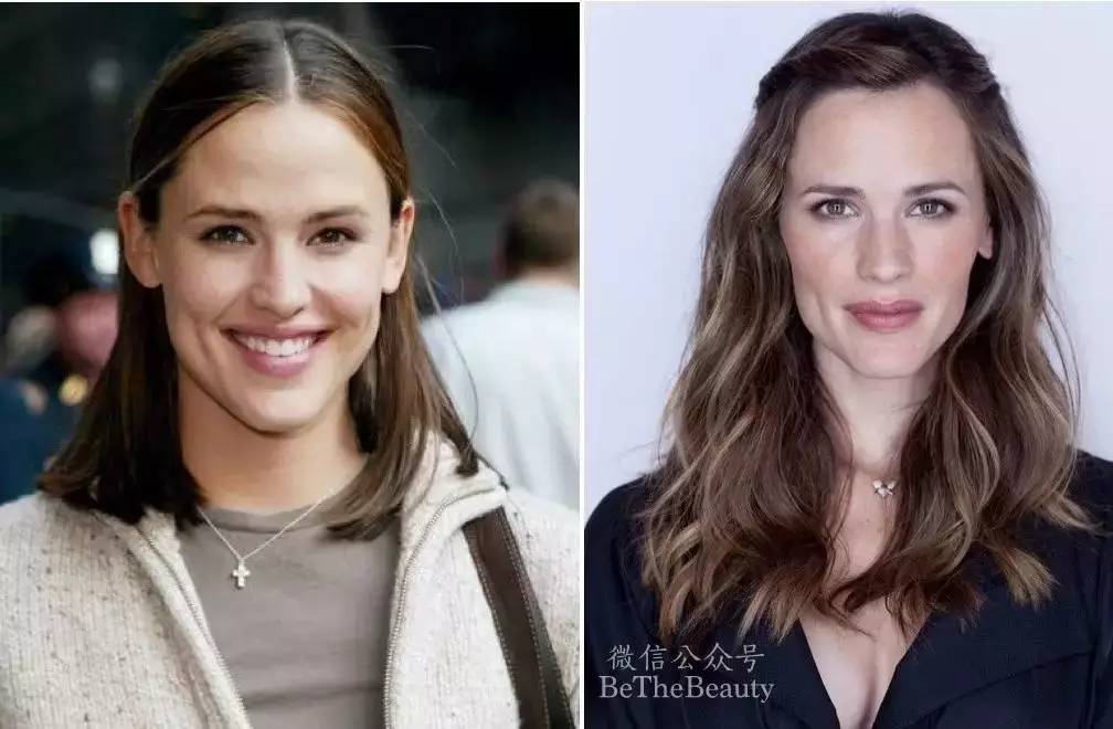 鎬庝箞璁╄劯鍨嬪彉寰楀ソ鐪嬪皬鍦嗚劯,濡備綍璁╄劯鍨嬪彉鎴愭祦鐣呭皬鍦嗚劯