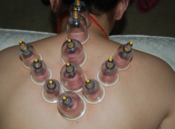 湿气重拔完火罐应该注意什么,能不能拔火罐祛湿毒