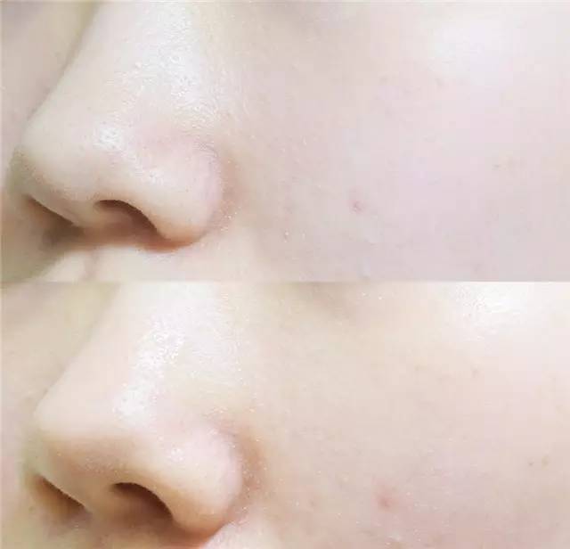 好用抗过敏的面膜,抗过敏好用的面膜