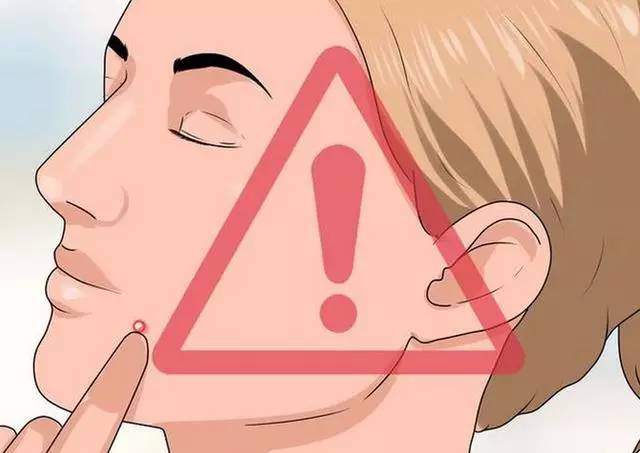 痘痘可以自己用针挤吗,痘可以挤吗