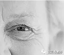 鱼尾纹，这样除最简单，一针即刻见效！