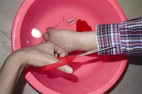 揪心！苏州一9月大婴儿惨遭烫伤，罪魁祸首竟是这件家电……