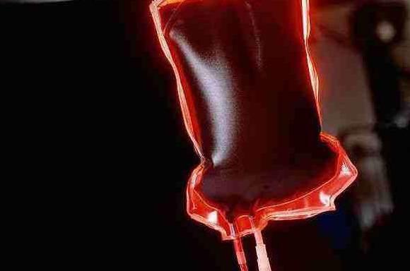 宁波郭女士的血好奇怪！温度低于31℃会凝固高于37℃化开！输血整整6小时，医生动破脑筋……