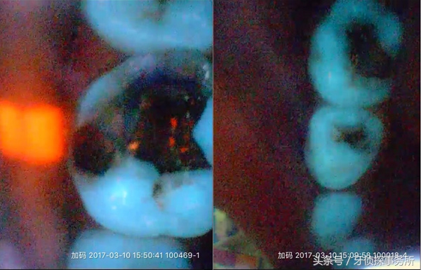 幼儿园口腔义诊数据,儿童口腔疾病义诊