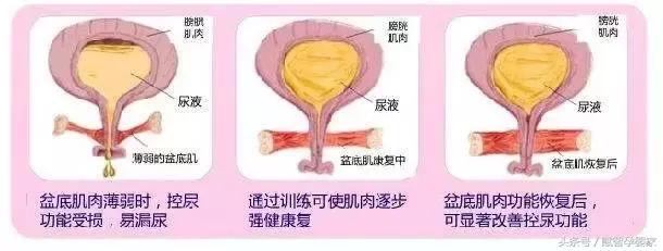 怀孕后期压力很大后悔了怎么办,怀孕后必知的8个真相