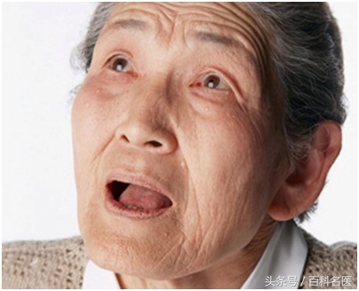 脑血栓有前兆当心这7个症状,脑血栓早期都有哪些症状