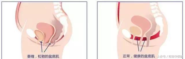 怀孕后期压力很大后悔了怎么办,怀孕后必知的8个真相