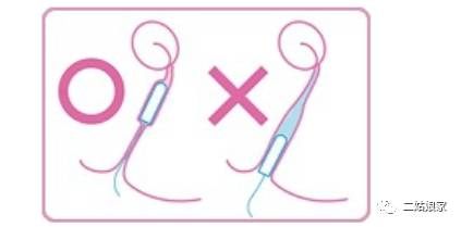 不用姨妈巾也可以止住血的东西,不用姨妈巾用啥代替