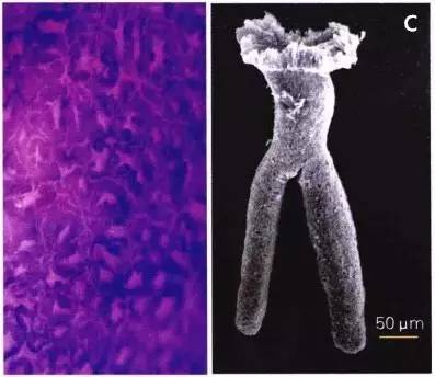 普通内镜与Pitpattern分型（多图详解）