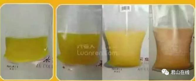 「今日君山」有一种健康很独特,她叫做捐献血浆!