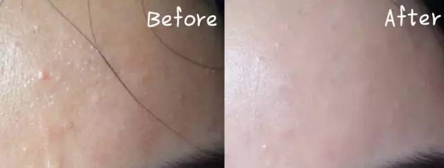 城野医生毛孔收敛水怎么用才有效,城野医生收缩毛孔水正确使用方法