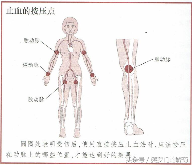 不小心受伤流血,流血受伤怎么处理好得快