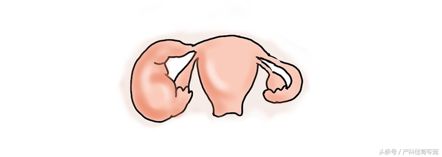 治疗盆腔炎最好最快是用什么药,盆腔炎能不能彻底治好