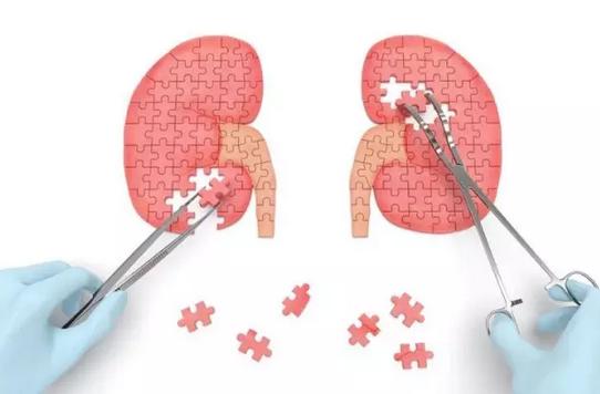 腰疼是因为肾结石着凉后就疼,腰疼和肾结石有关系吗