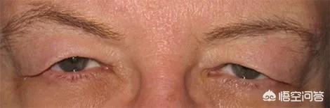 16日时尚精选：怎么能让塌下来的眼皮提上去？