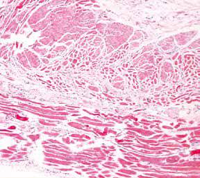 内镜做病理分析大概多久,作为一个医生太感性怎么办