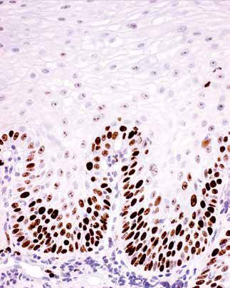 内镜做病理分析大概多久,作为一个医生太感性怎么办