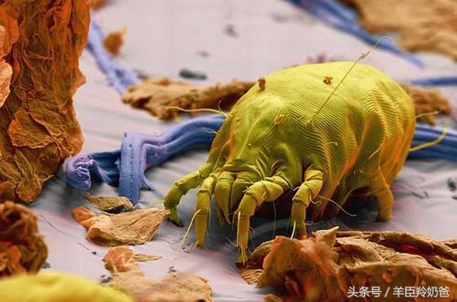 宝宝湿疹反复发作怎么办,为什么会导致宝宝湿疹反反复复