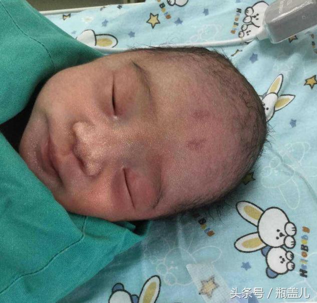 34周早产宝宝1.97公斤算正常吗,34周早产宝宝不比任何人差