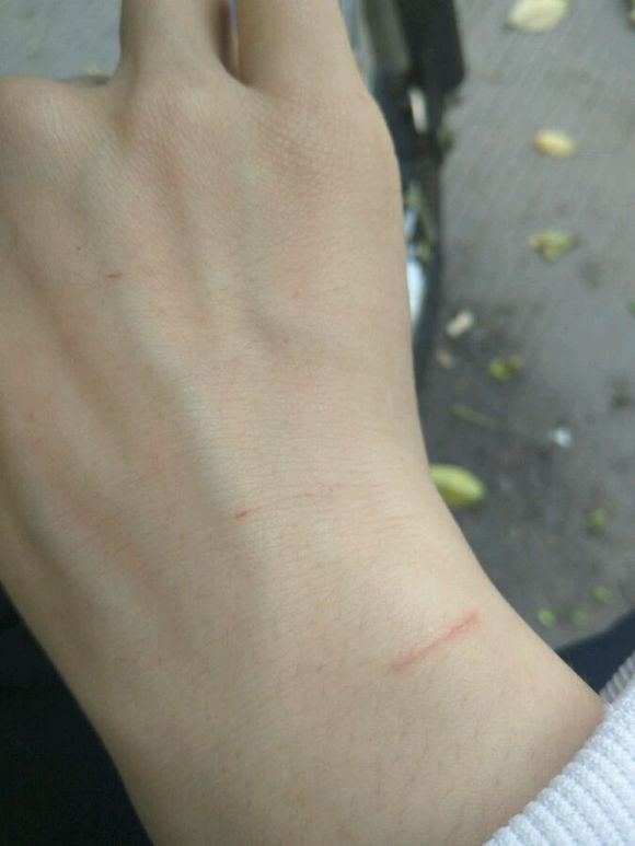 十天前被小狗咬伤了,猫抓伤人后为什么猫死了