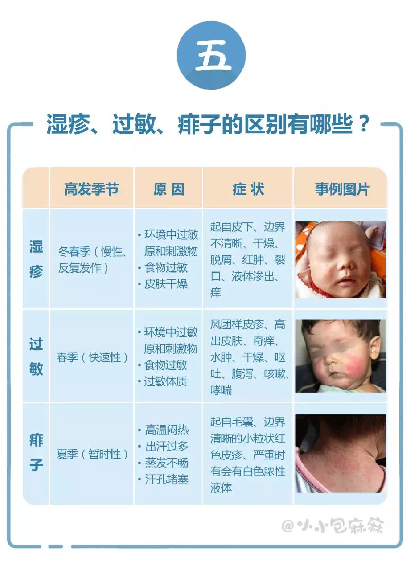 1岁宝宝下巴湿疹反复发作怎么办,湿疹停药就反复发作