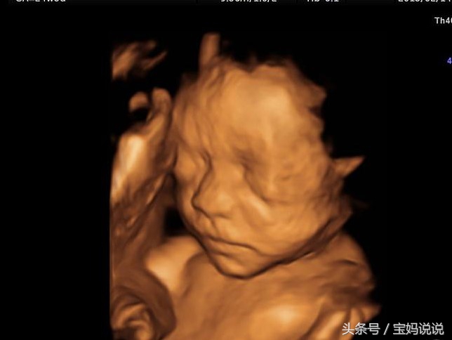 孕期“绝不能少”四次彩超检查你知道吗？让超声科大夫告诉你……