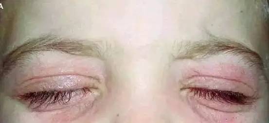 美睫如何避免美睫师颈椎痛,美睫师应根据什么条件设计美睫