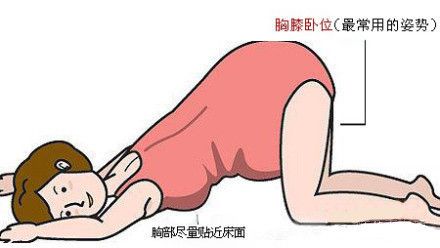 异常胎位纠正视频,异常胎位是怎么导致的