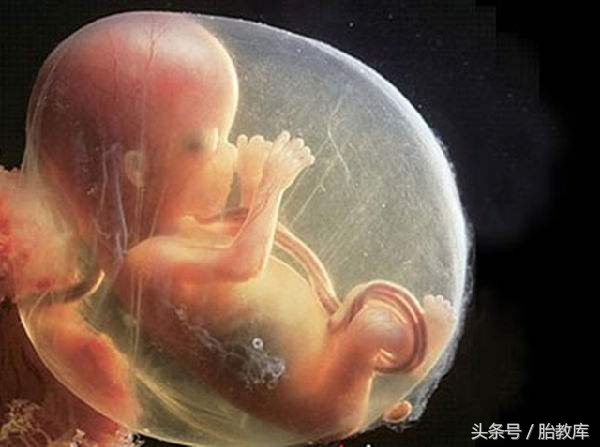 羊水指数afi正常范围,39周羊水指数正常范围