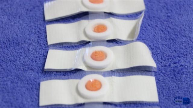 德国空心刀挖鸡眼,鸡眼不挖会自愈吗