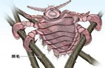 医生警惕这3种传染病,医生提醒两类人尤其要当心