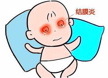 清胎毒和清羊水一样意思吗,孕期要去胎毒吗胎毒究竟是什么