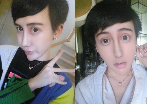 香港最老明星整容失败照片对比,整容失败的明星有哪些