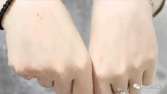 绉戝鎶よ偆鐩茬洰绉嶈崏,绉戝绉嶈崏