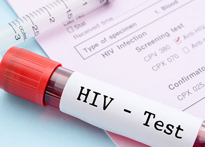 hiv阳性给做肠胃镜检查吗,hiv检查结果显示有反应