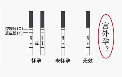 如何判断是早孕反应还是胃病,怎么判断是早孕