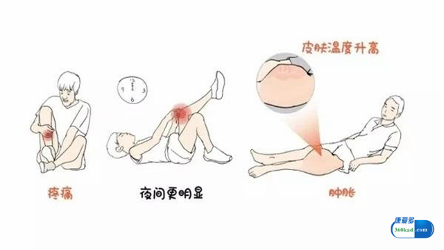 骨肉瘤常见还是骨转移瘤常见,骨瘤和骨肉瘤的区别