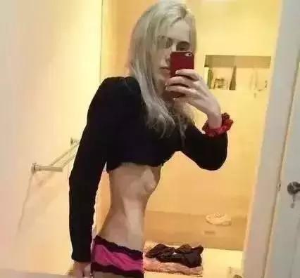 节食减肥的后果太可怕了图片,减肥路上总有些毒瘤