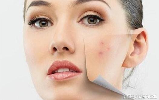 痘坑怎么修复点阵激光操作过程,激光痘疤修复凹洞痘坑要多久