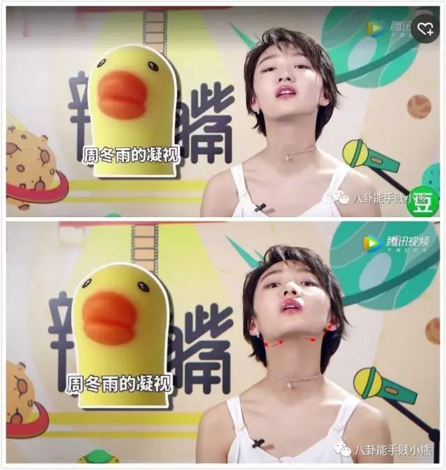 周冬雨鹿晗黄子韬的同款不对称下颌角，值得拥有吗？