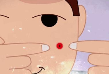 正确祛痘思路,改掉挤痘坏习惯这样祛痘不伤肤