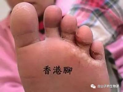 脚臭是因为真菌还是细菌,你的脚臭不臭