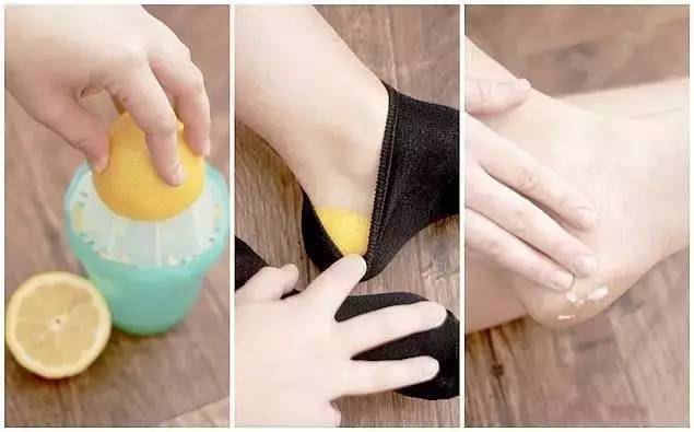 鞋子有异味快速去除,鞋子有臭味怎么去除小妙招