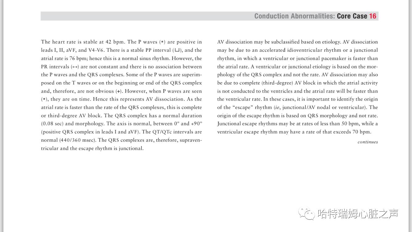 「读心有术」057期：这么多的T波倒置，该怎样诊断？