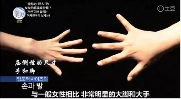 韩国整容手术恢复过程,韩国一个整容的综艺节目