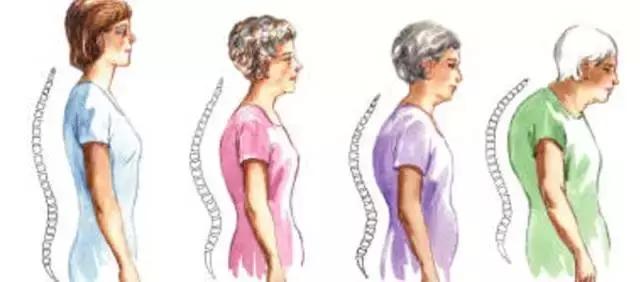 更年期骨质疏松要怎么办,更年期如何补钙防骨质疏松