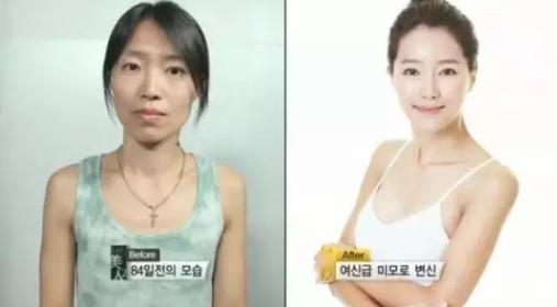 韩国整容手术恢复过程,韩国一个整容的综艺节目